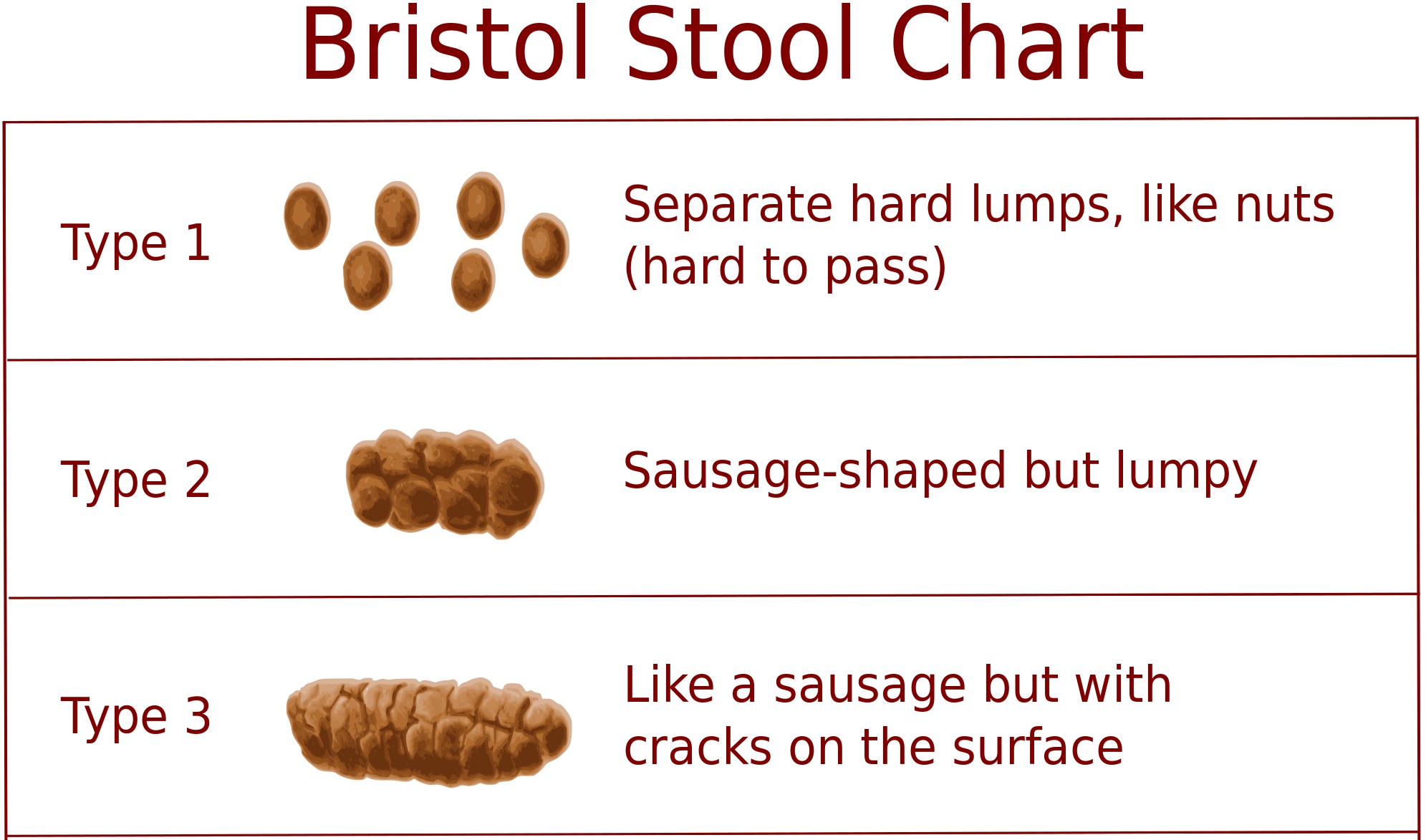 Stool Chart Type 1